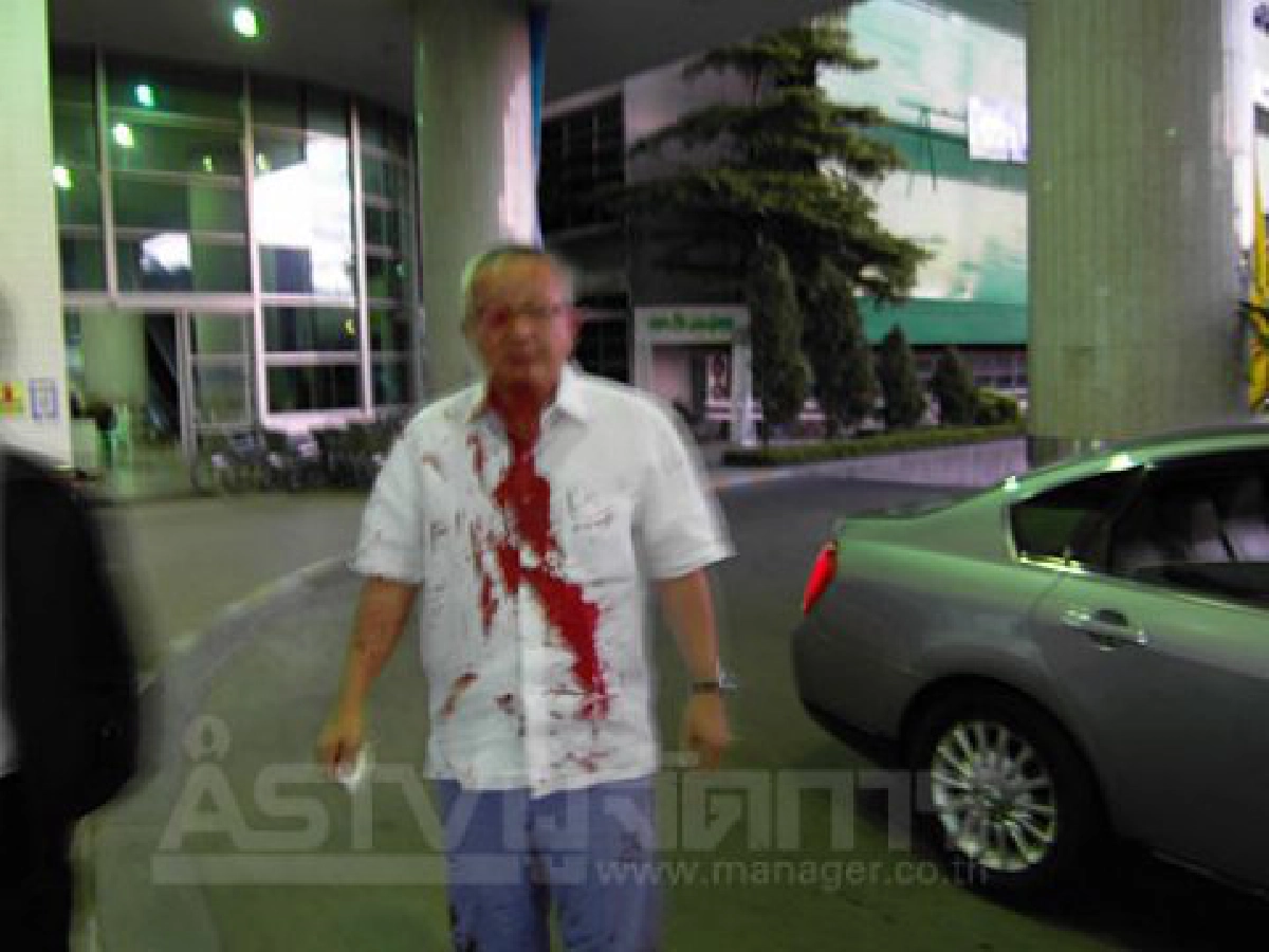 ยิงถล่มรถสนธิ ลิ้มทองกุลเจ็บพร้อมคนขับ