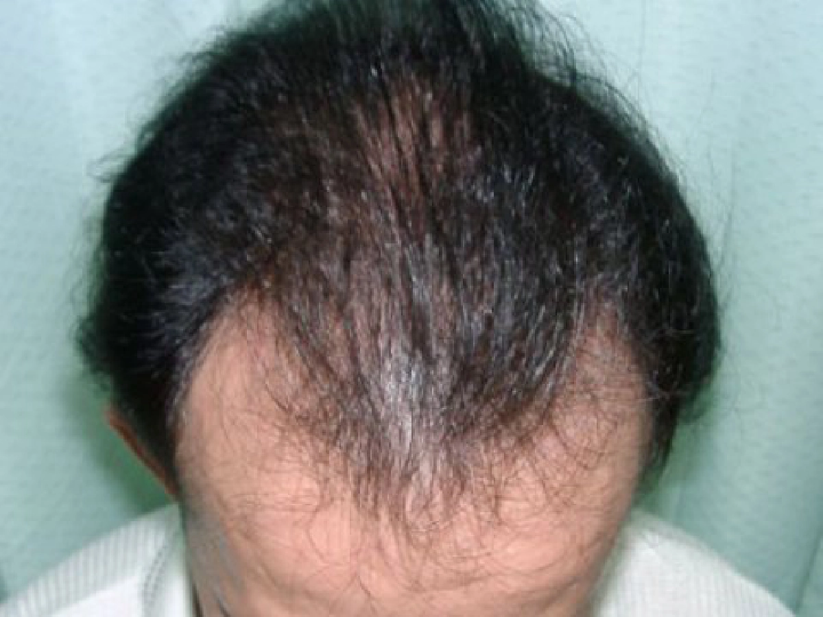 ไขปัญหาสุขภาพแผนจีน - เกิดจากภาวะไตอ่อนแอใช่มั้ย???