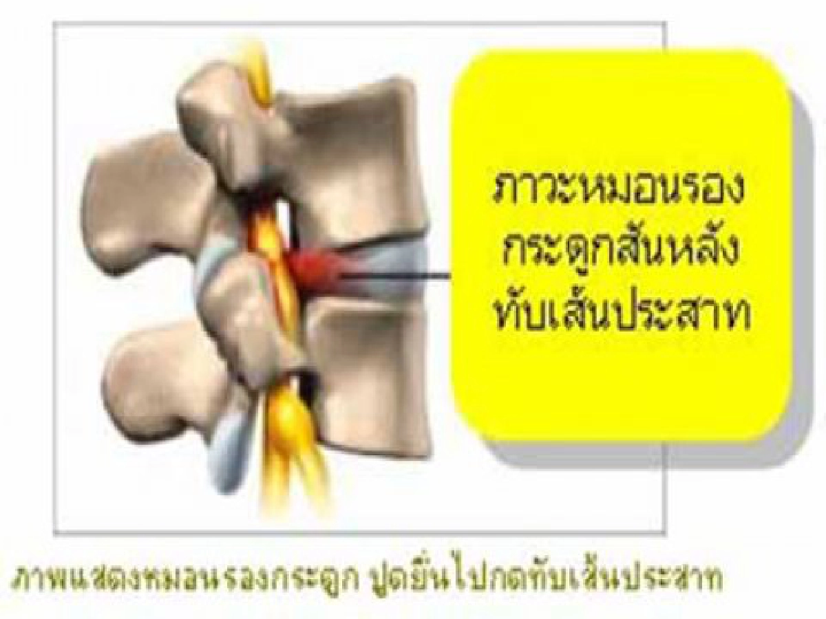 คนไทยวัย 40+ ปวดคอ คนไทยวัย 40+ ปวดคอ
