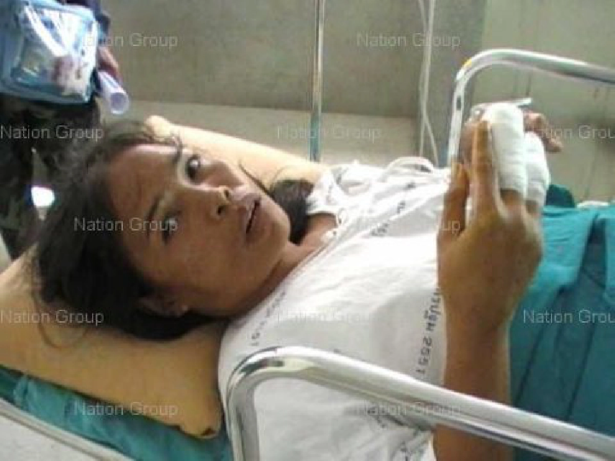 โวยขึ้นรถบัสประตูหนีบนิ้วขาด-คนขับจอดทิ้งข้างทาง โวยขึ้นรถบัสประตูหนีบนิ้วขาด-คนขับจอดทิ้งข้างทาง