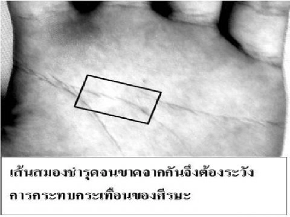 วัยรุ่นที่คิดฆ่าตัวตาย วัยรุ่นที่คิดฆ่าตัวตาย