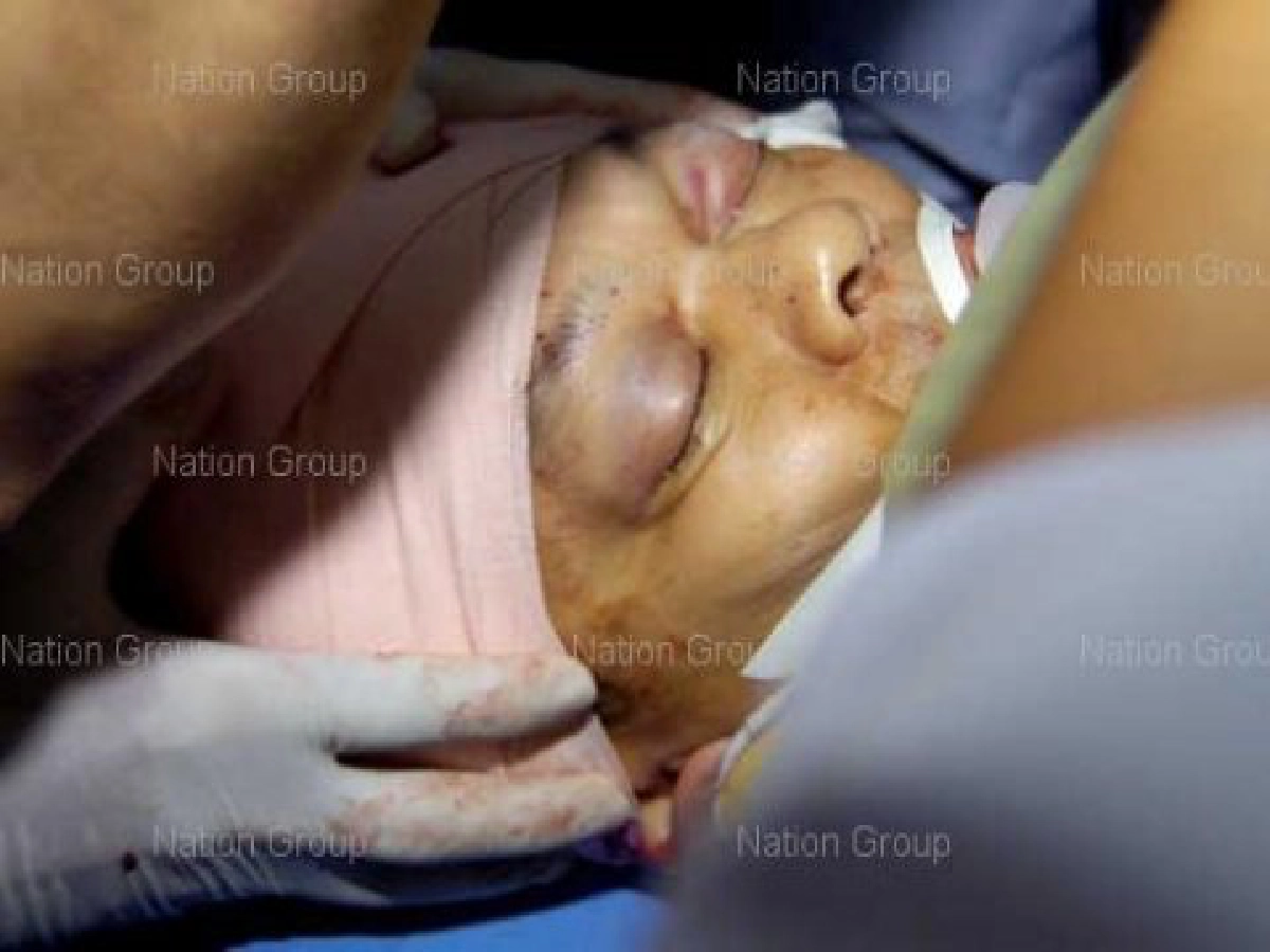  "สไนเปอร์"คำตอบสุดท้าย...เสธ.แดง 