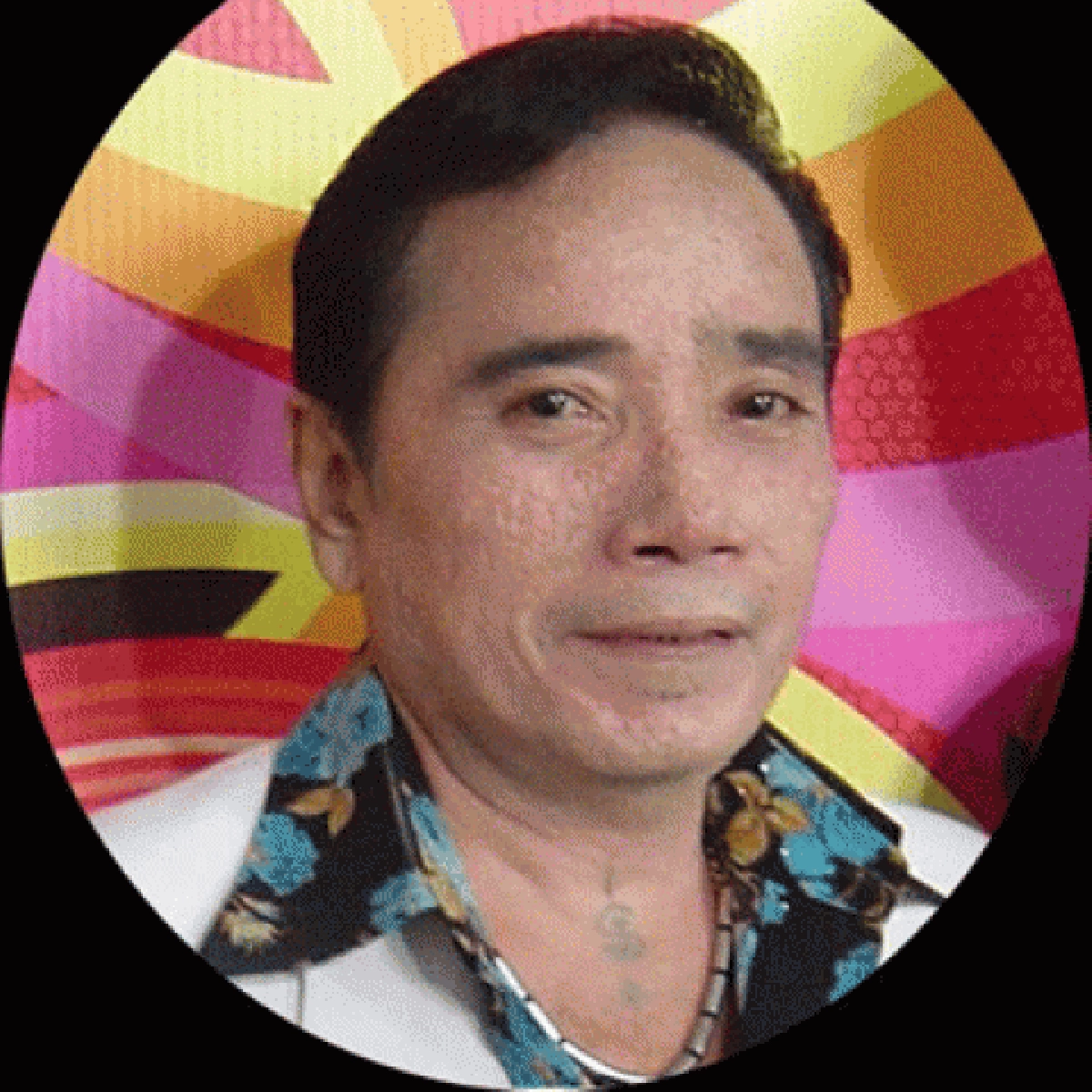 'ศรเพชร'ผ่าตัดหมอประกาศหาเลือด
