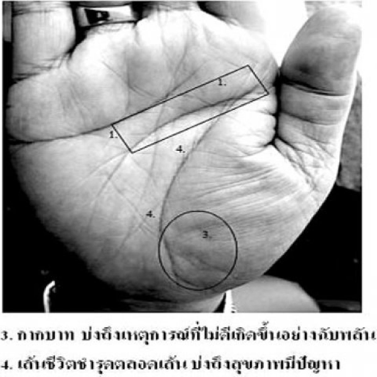 เส้นบอกโรคร้ายของ"ว่าที่ร.ต.ไพโรจน์ สุวรรณฉวี"