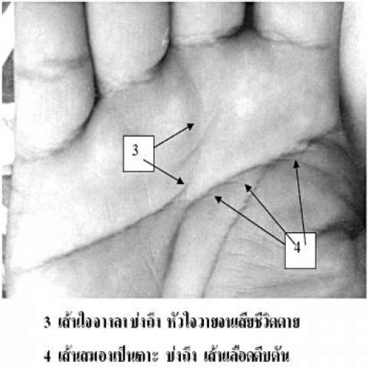 ตายด้วยโรคหัวใจ ตายด้วยโรคหัวใจ