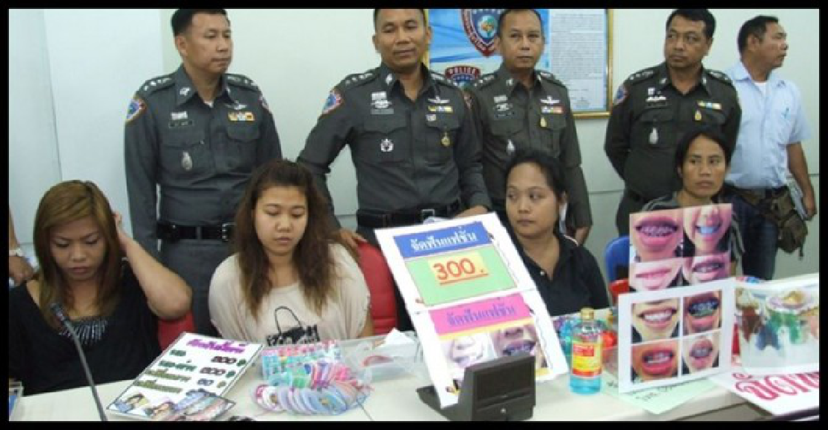 ปคบ.จับร้านดัดฟันแฟชั่นในห้างดัง