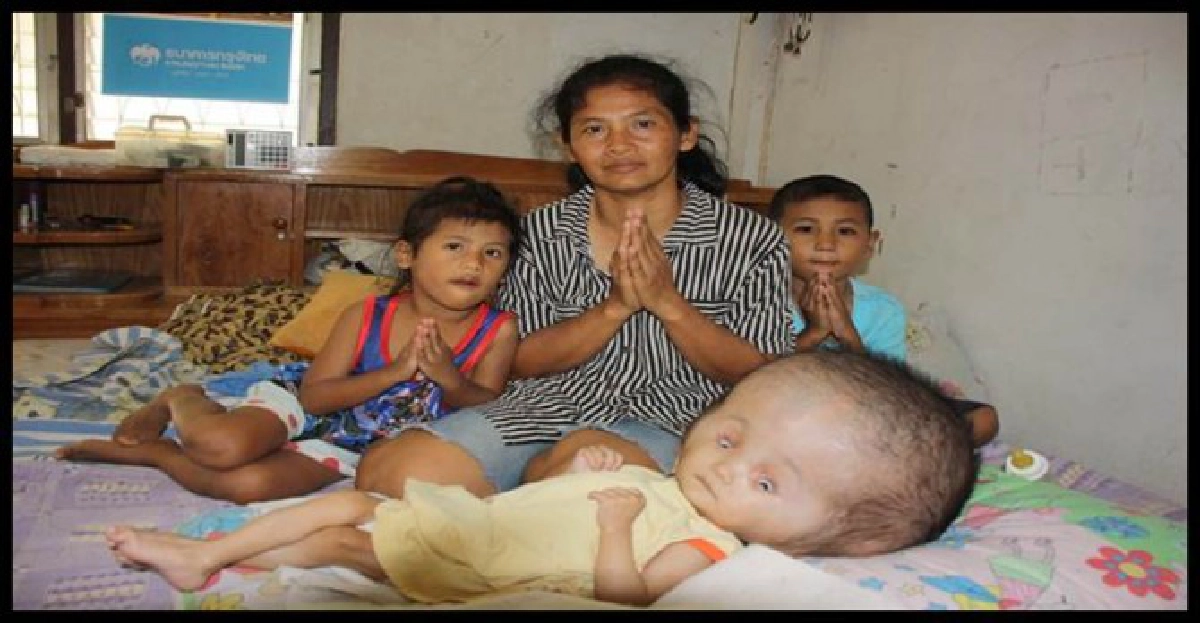 2ขวบหัวโตพ่อแม่วอนช่วยรักษาลูก!