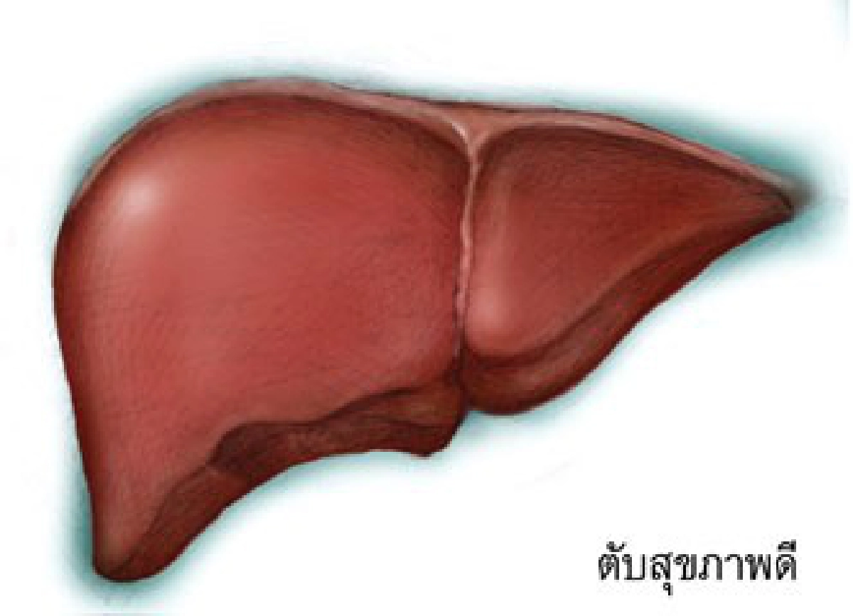 หยุดไวรัสตับอักเสบบี 
ต้านภัยมะเร็งตับ "เฉลิมพระเกียรติ 84พรรษา 