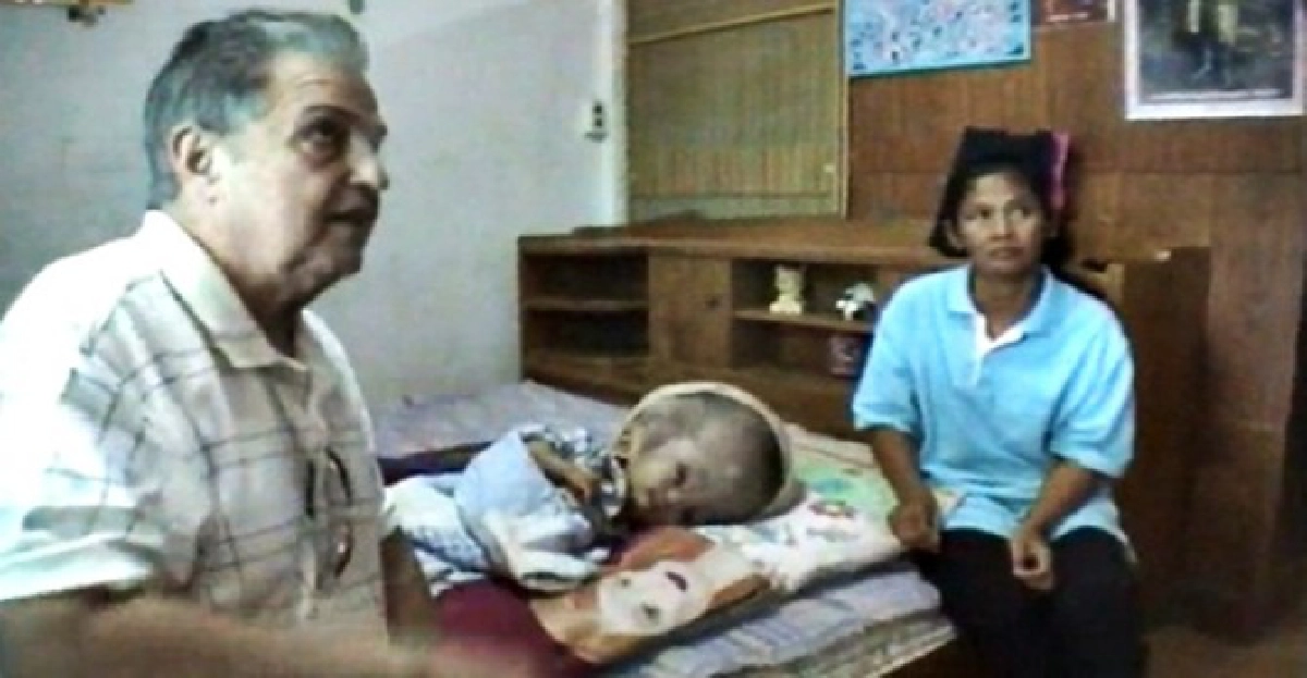 ดร.ชาวอเมริกันรับอุปถัมภ์เด็กศีรษะโต
