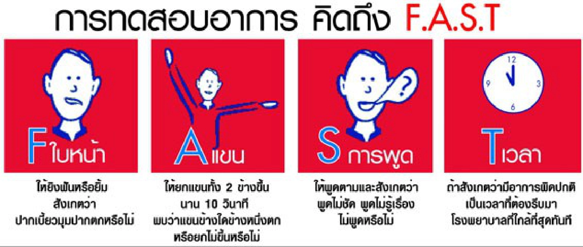 โรคหลอดเลือดสมอง โรคหลอดเลือดสมอง