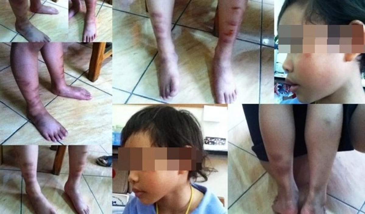 อนาถภาพเด็กถูกทำร้ายว่อนเว็ต