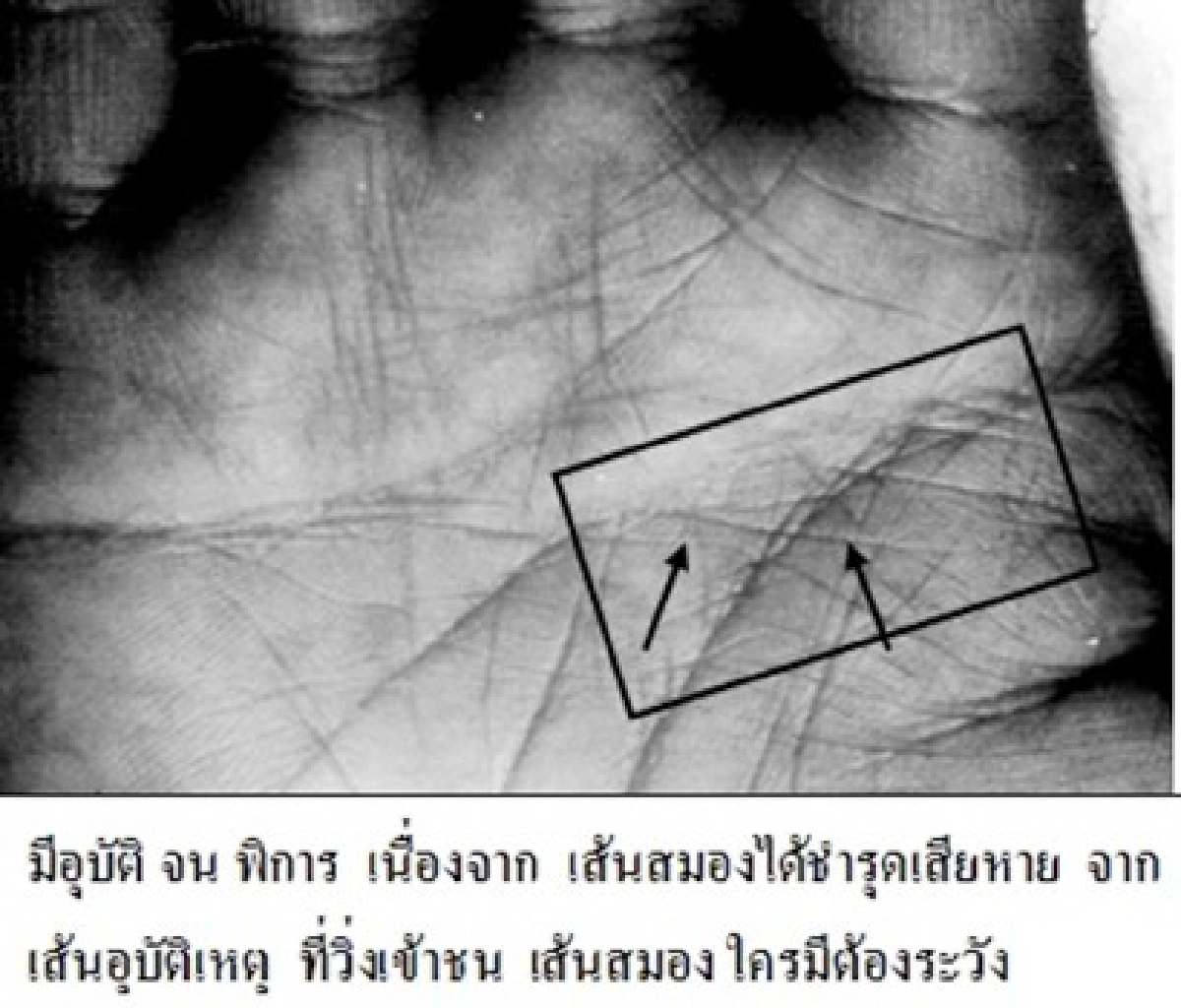 หัตถศาสตร์ : สงกรานต์กับอุบัติเหตุ
หัตถศาสตร์ : สงกรานต์กับอุบัติเหตุ