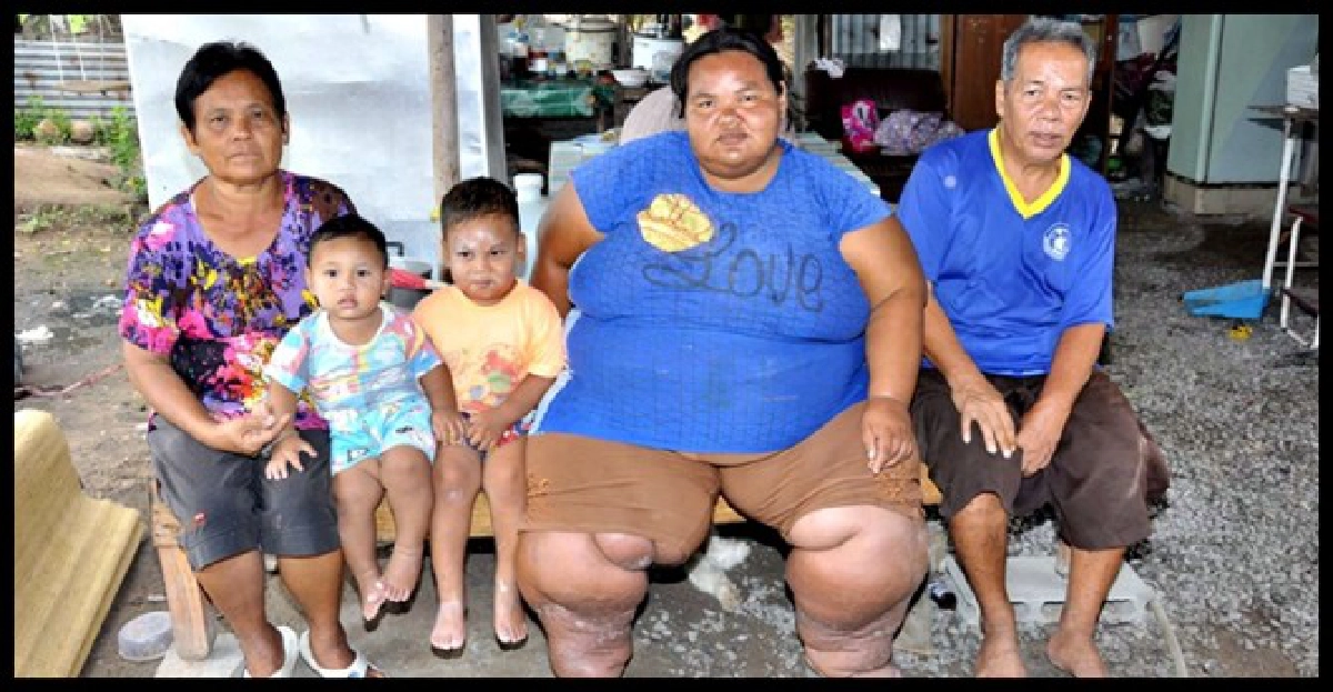 สาวหนัก200กก.วอนช่วย!พ่อป่วยอัมพฤกษ์ สาวหนัก200กก.วอนช่วย!พ่อป่วยอัมพฤกษ์