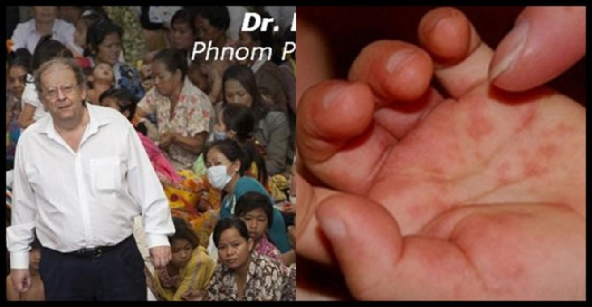 ปมปริศนา'ไวรัสอีวี71'โรคลึกลับเขมร