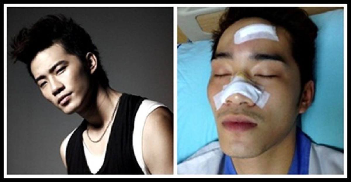 4โจรดักตี-ปล้นชิงทรัพย์'บี้ เคพีเอ็น'เย็บ33เข็ม 4โจรดักตี-ปล้นชิงทรัพย์'บี้ เคพีเอ็น'เย็บ33เข็ม