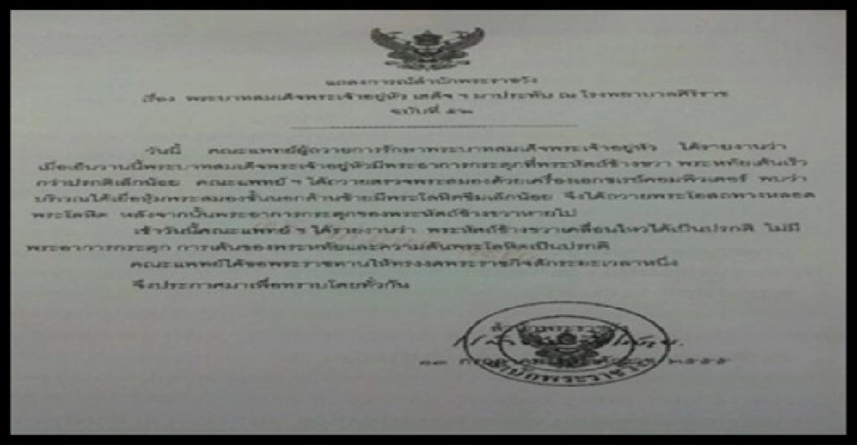'ในหลวง'พระหทัยเต้นเร็วสมองโลหิตซึม 'ในหลวง'พระหทัยเต้นเร็วสมองโลหิตซึม