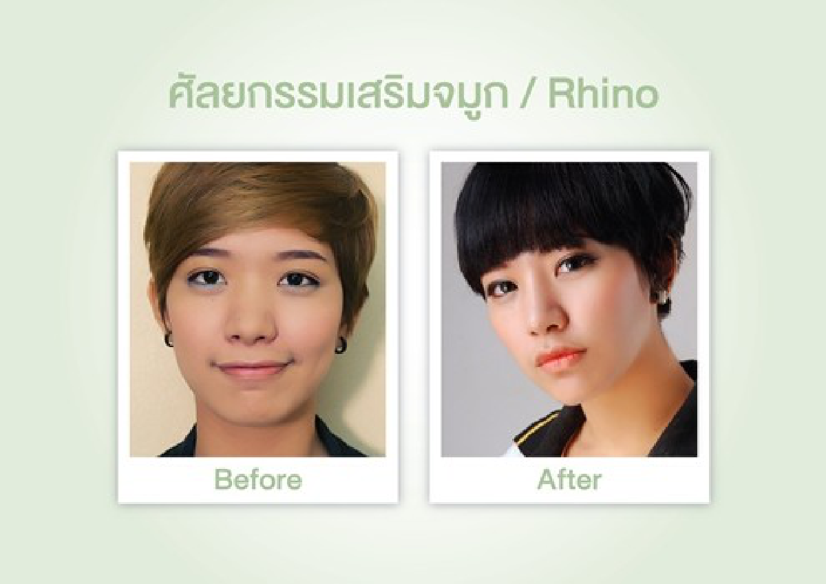 ศัลยกรรมอย่างไรให้'สวย...เอาอยู่!!'