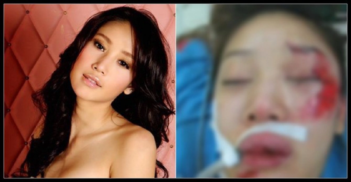 อุบัติเหตุหวิดทำหน้า'ดารา'พัง อุบัติเหตุหวิดทำหน้า'ดารา'พัง