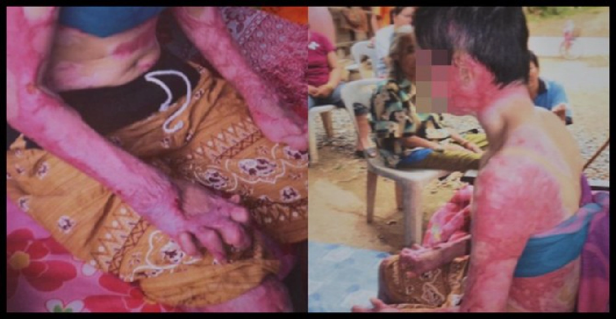 วอนช่วยหญิงวัย30ถูกอดีตสามี'เผาทั้งเป็น' วอนช่วยหญิงวัย30ถูกอดีตสามี'เผาทั้งเป็น'