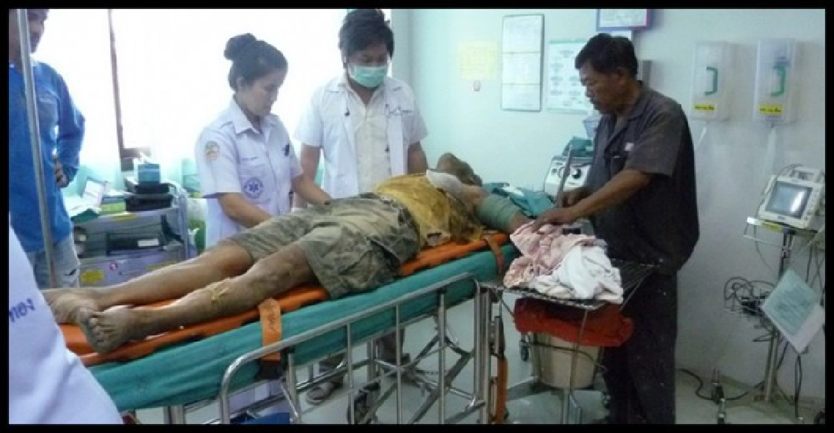 เครื่องอบข้าวบดแขนคนงานเลาะ
เครื่องอบข้าวบดแขนคนงานเลาะ