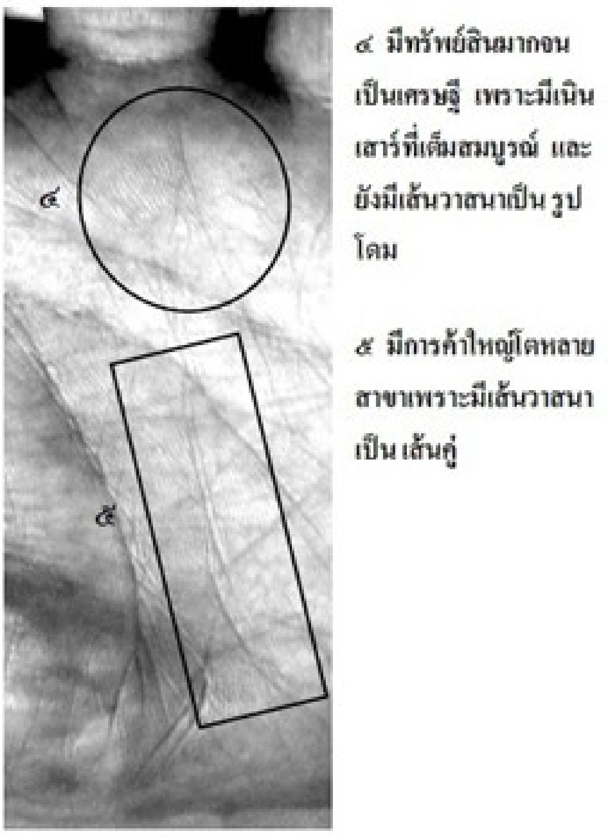 เศรษฐีกลัวตาย แต่ไม่กลัวเกิด!!?
