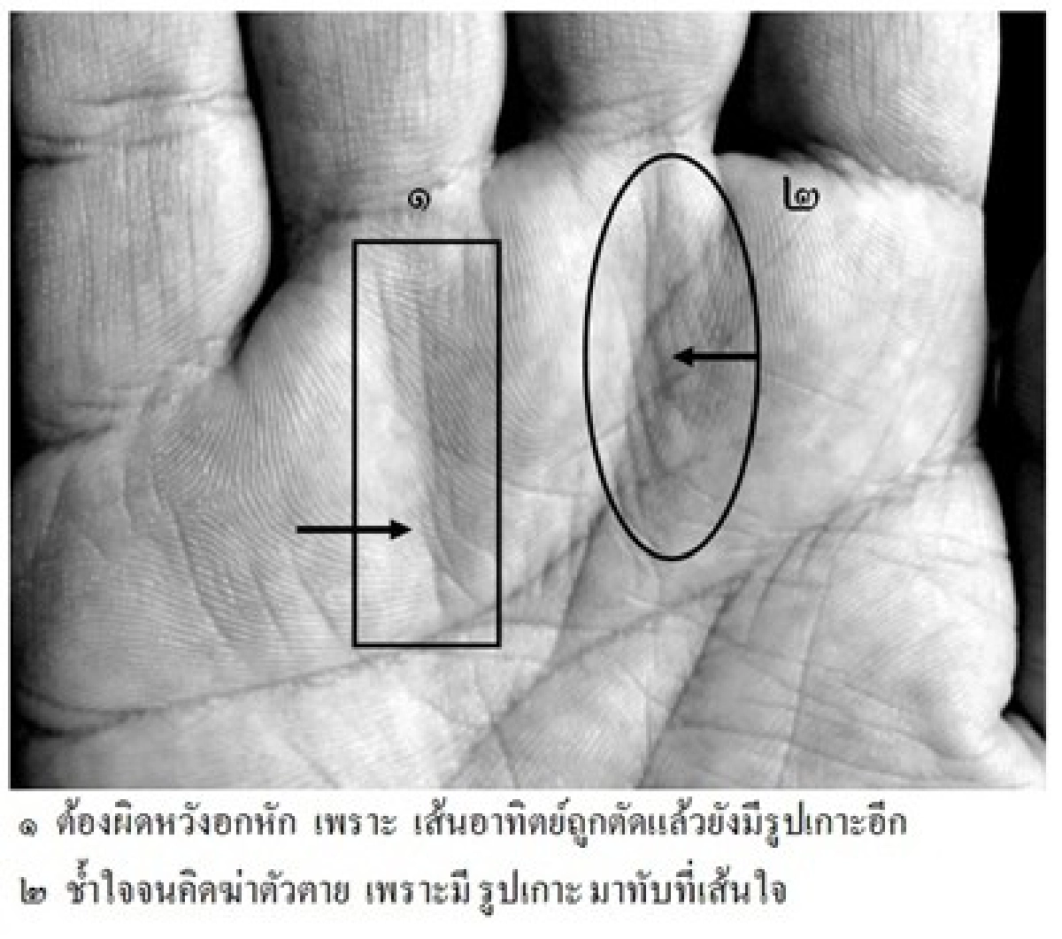 หัตถศาสตร์:ครูลิลลี่ เกิดมาไม่เสียชาติเกิด!?
หัตถศาสตร์:ครูลิลลี่ เกิดมาไม่เสียชาติเกิด!?
