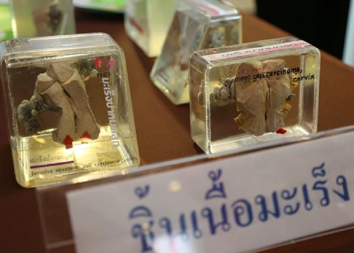 กองทุนสร้างโอกาสให้ผู้ป่วยมะเร็งสตรี