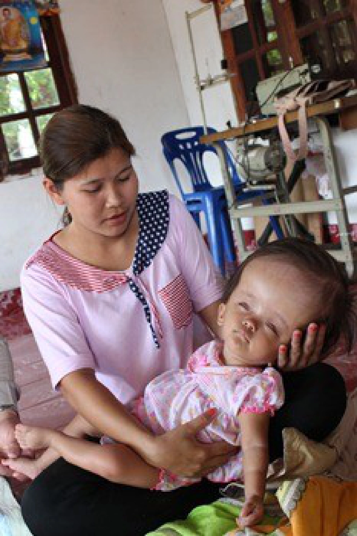 น่าเวทนา!'น้องอุ๋งอิ๋ง'วัยขวบเศษพิการหัวโต น่าเวทนา!'น้องอุ๋งอิ๋ง'วัยขวบเศษพิการหัวโต