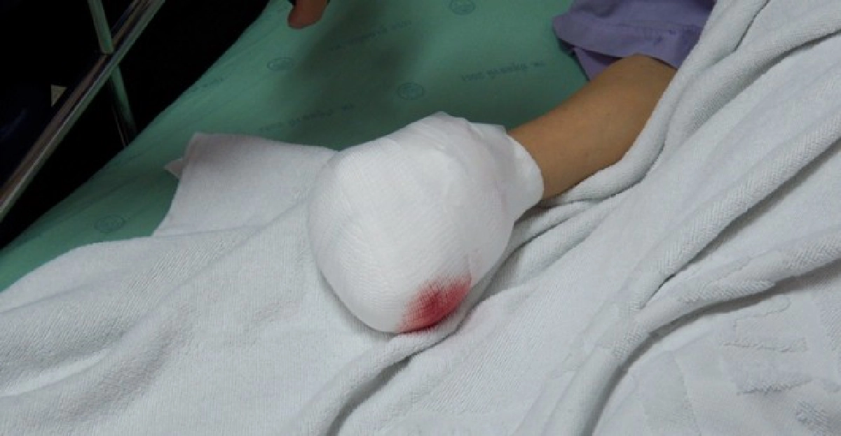 สยอง!ยายจุดประทัดยักษ์บึ้มใส่มือเละ สยอง!ยายจุดประทัดยักษ์บึ้มใส่มือเละ