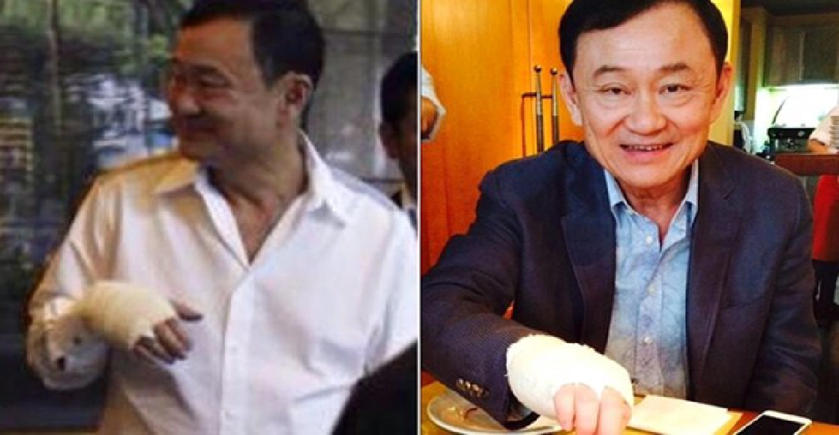 'อุ๊งอิ๊ง'เฉลย'แม้ว'ผ้าพันมือ!แจง'พ่อแค่เจ็บมือ' 'อุ๊งอิ๊ง'เฉลย'แม้ว'ผ้าพันมือ!แจง'พ่อแค่เจ็บมือ'