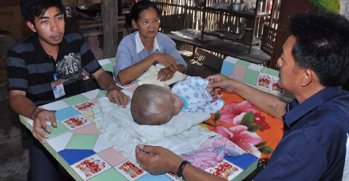 วอนช่วย!เด็ก5เดือนหัวโตผิดปกติ วอนช่วย!เด็ก5เดือนหัวโตผิดปกติ