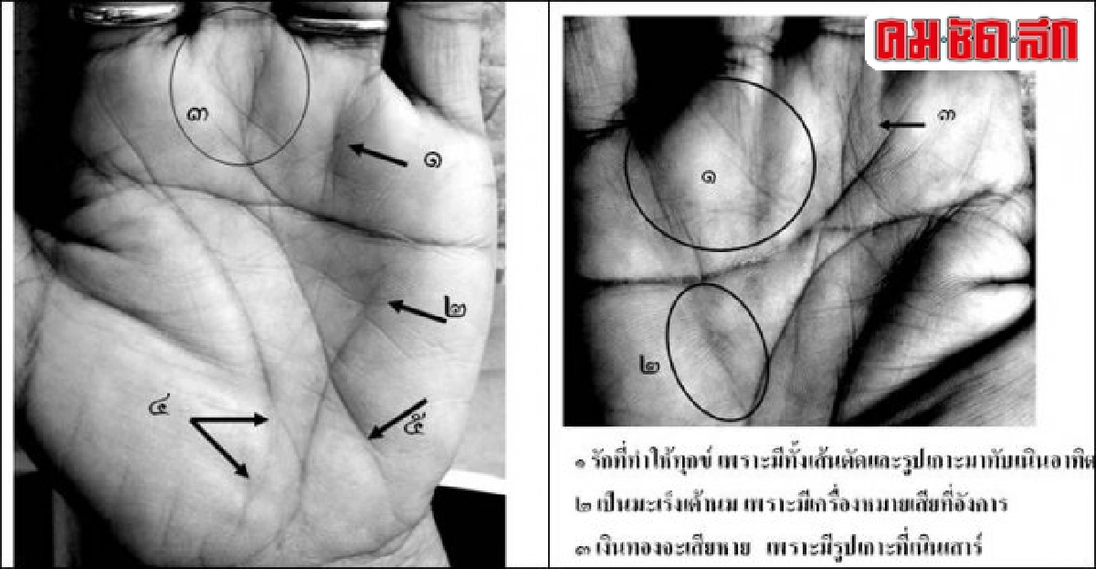 หัตถศาสตร์:'หนูจะถูกตัดเต้านมหรือไม่ !!?'