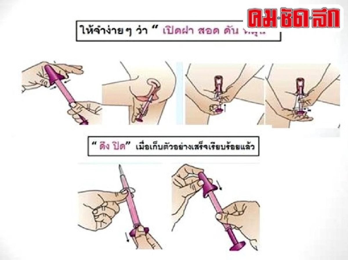เพื่อหญิงขี้อายห่างไกลมะเร็งปากมดลูก