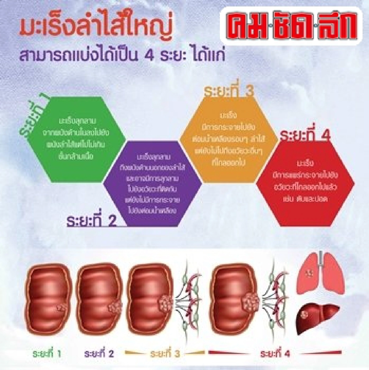 'ฟ้าหญิงจุฬาภรณ์'พระราชทานโครงการรักษามะเร็ง 'ฟ้าหญิงจุฬาภรณ์'พระราชทานโครงการรักษามะเร็ง