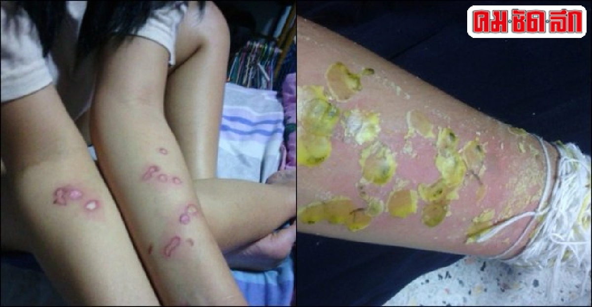 ภาคทัณฑ์!รุ่นพี่รับน้องโหด