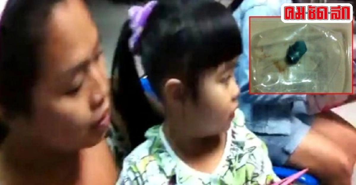 อุทาหรณ์!4ขวบยัดยางรัดผมใส่รูจมูกนับเดือน อุทาหรณ์!4ขวบยัดยางรัดผมใส่รูจมูกนับเดือน