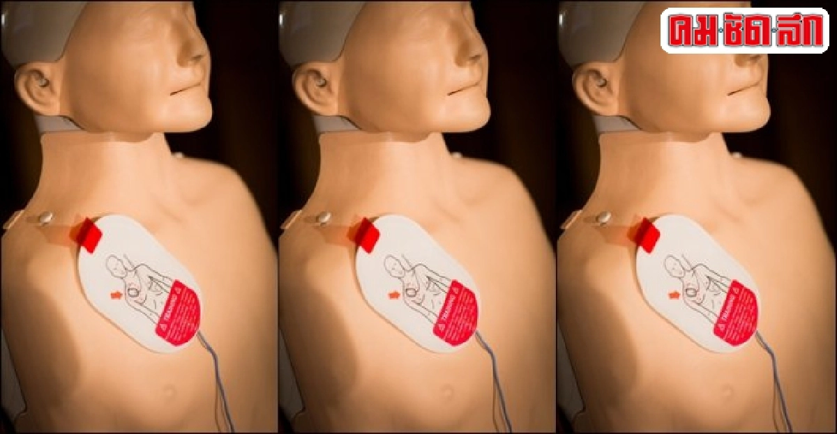 ผู้ป่วยหัวใจวาย....สู่ทางรอดด้วยการติดตั้งเครื่อง AED ผู้ป่วยหัวใจวาย....สู่ทางรอดด้วยการติดตั้งเครื่อง AED