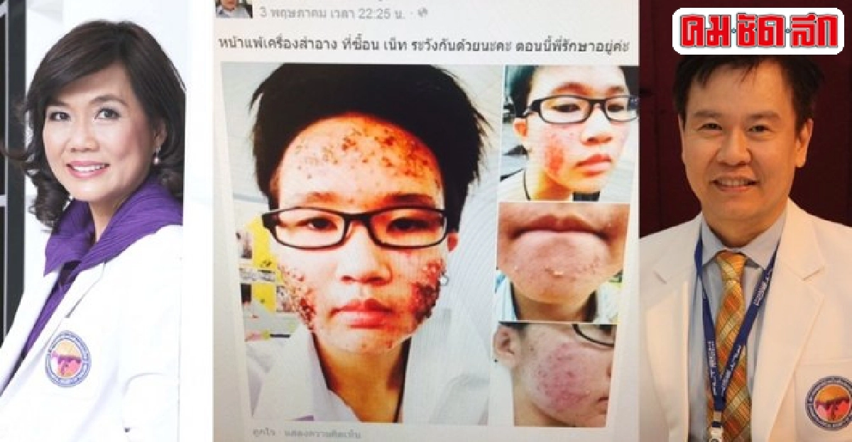 แพทย์ผิวหนังเตือนซื้อเครื่องสำอางผ่านเน็ต