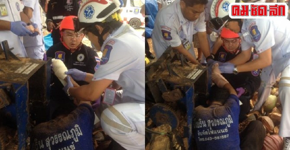 หนุ่มถูกเครื่องบดเปลือกมะพร้าวปั่น4นิ้วเละ