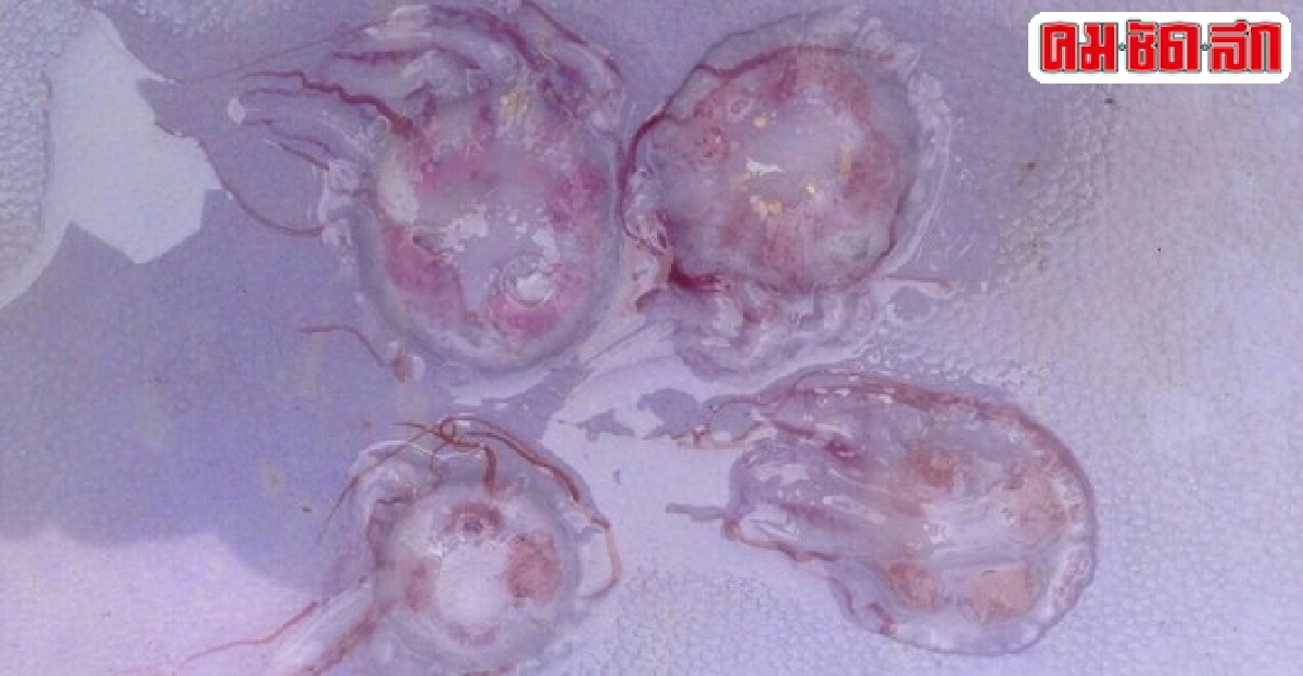 แมงกะพรุนกัดนักท่องเที่ยวเยอรมันเสียชีวิต1เจ็บ1 แมงกะพรุนกัดนักท่องเที่ยวเยอรมันเสียชีวิต1เจ็บ1