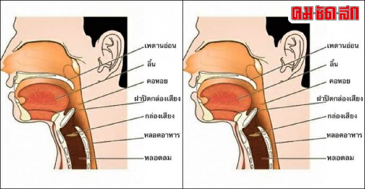 ภัยจากการสำลักอาหาร-น้ำในผู้สูงอายุ
