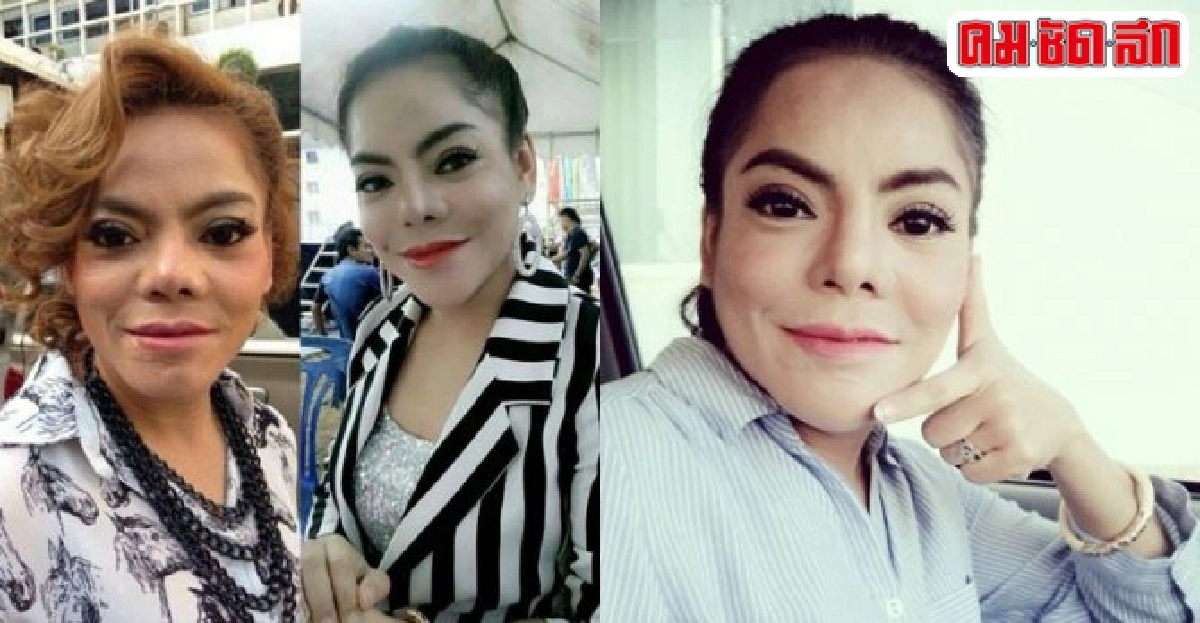 นุจรี อีแหววไม่สิ้นหวังหมอไทยเนรมิตหน้าใหม่สวย นุจรี อีแหววไม่สิ้นหวังหมอไทยเนรมิตหน้าใหม่สวย