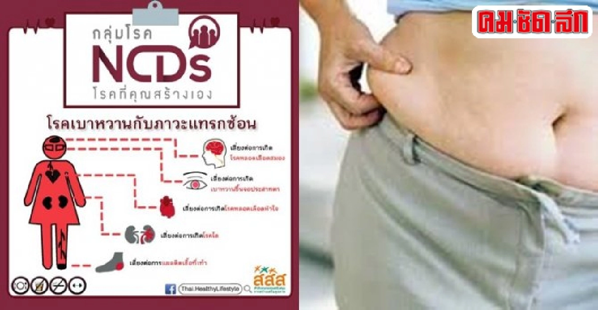 ชงรัฐขึ้นภาษีเครื่องดื่มผสมน้ำตาลเกินมาตรฐาน