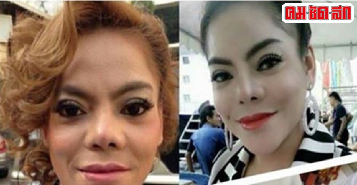 'นุจรี อีแหวว'ไม่สิ้นหวังหมอไทยทำหน้าใหม่สวย