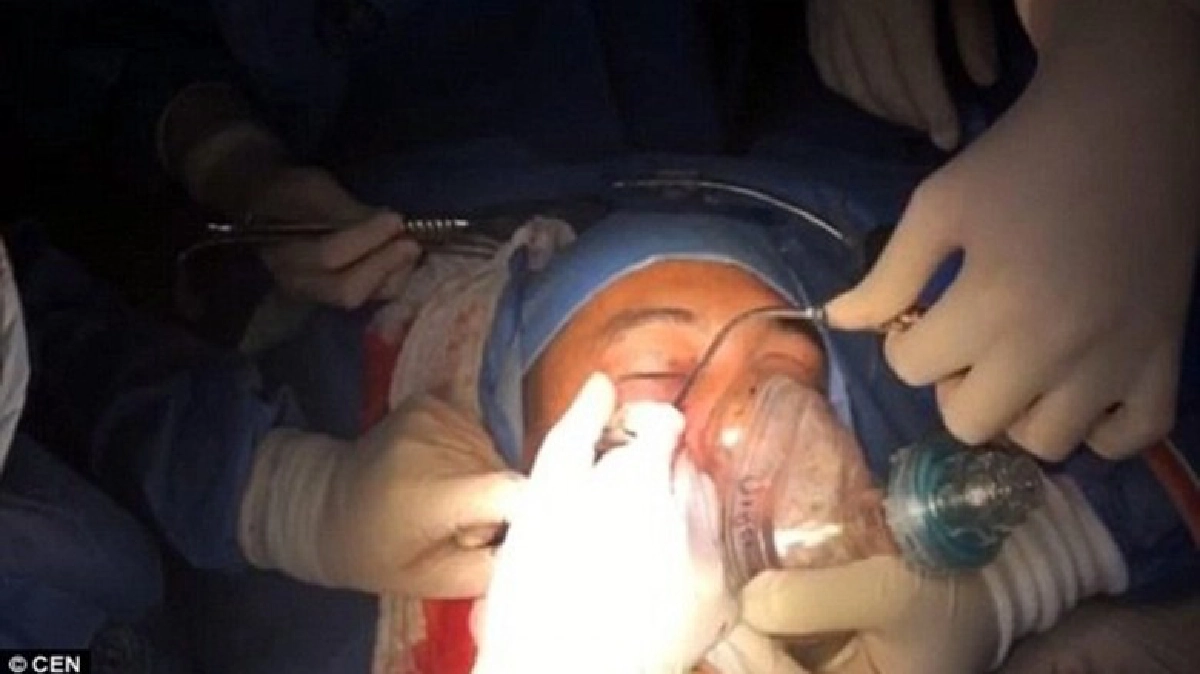 หมอโคลัมเบียเจ๋งผ่าตัดคีบลูกระเบิดฝังหน้าทหาร 