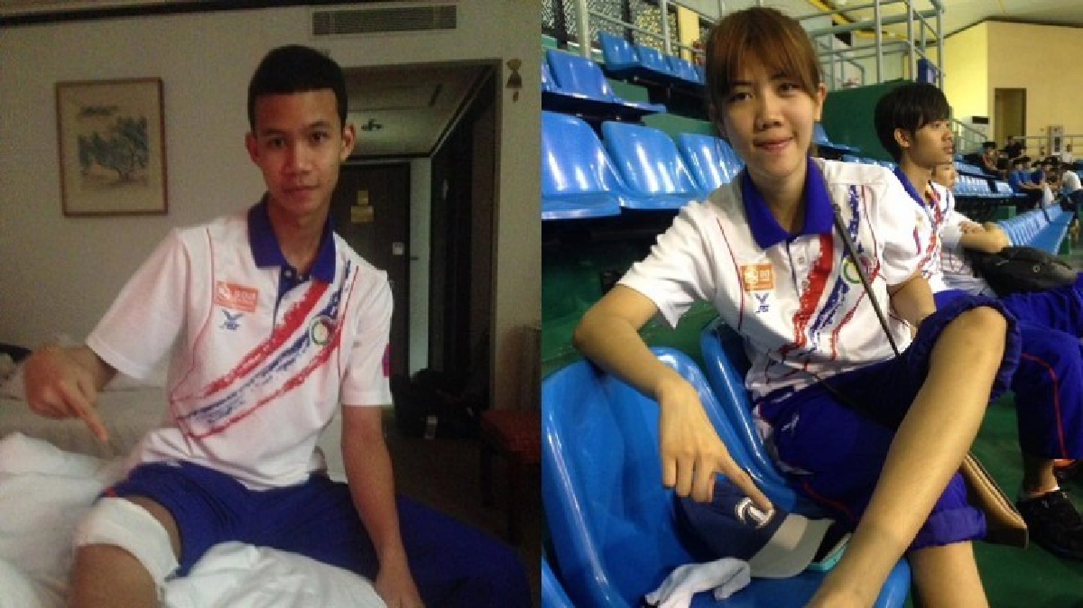 ฝังเข็มช่วยรักษา 3 จอมเตะลุยโอลิมปิก ฝังเข็มช่วยรักษา 3 จอมเตะลุยโอลิมปิก