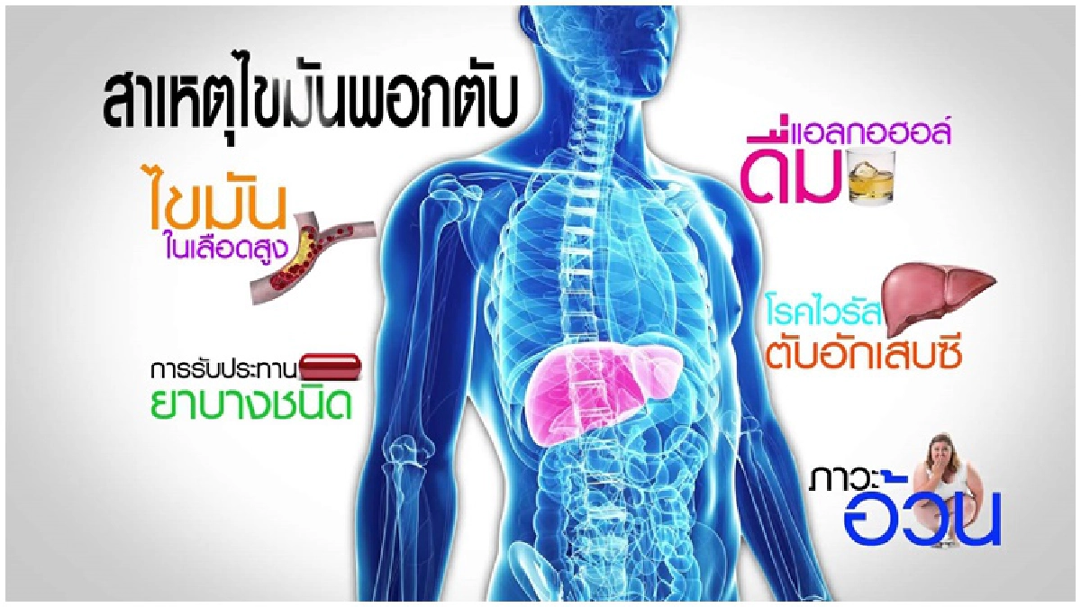 ไขมันสะสมจนพอกตับ