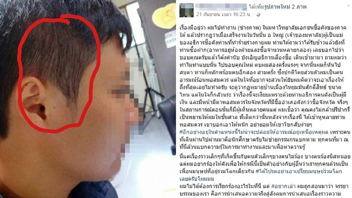 หนุ่มโพสต์แฉ! ถูก อธิการม.ดัง ตบหน้า