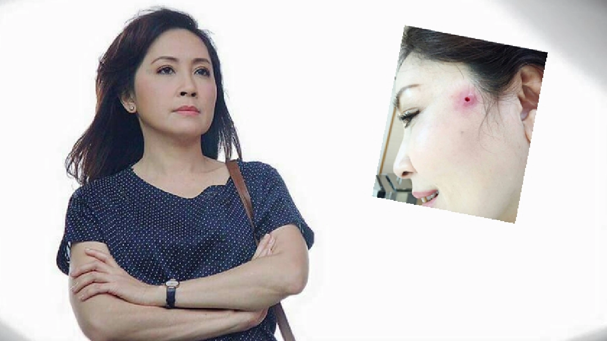 ‘กวาง-กมลชนก’ เผยอุทาหรณ์มือบอนเสี่ยงเสียโฉม ‘กวาง-กมลชนก’ เผยอุทาหรณ์มือบอนเสี่ยงเสียโฉม