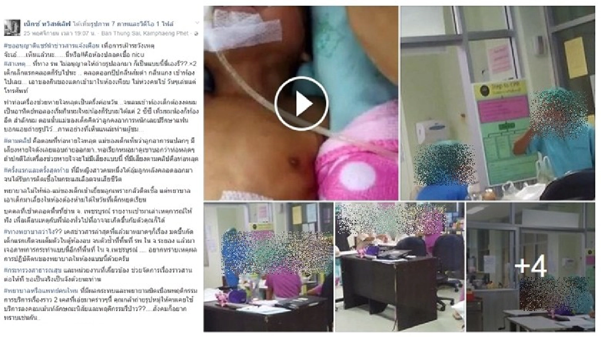 โวยรพ.ทำท่อหายใจทารกแรกเกิดหลุด